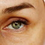 under-eye filler procedure